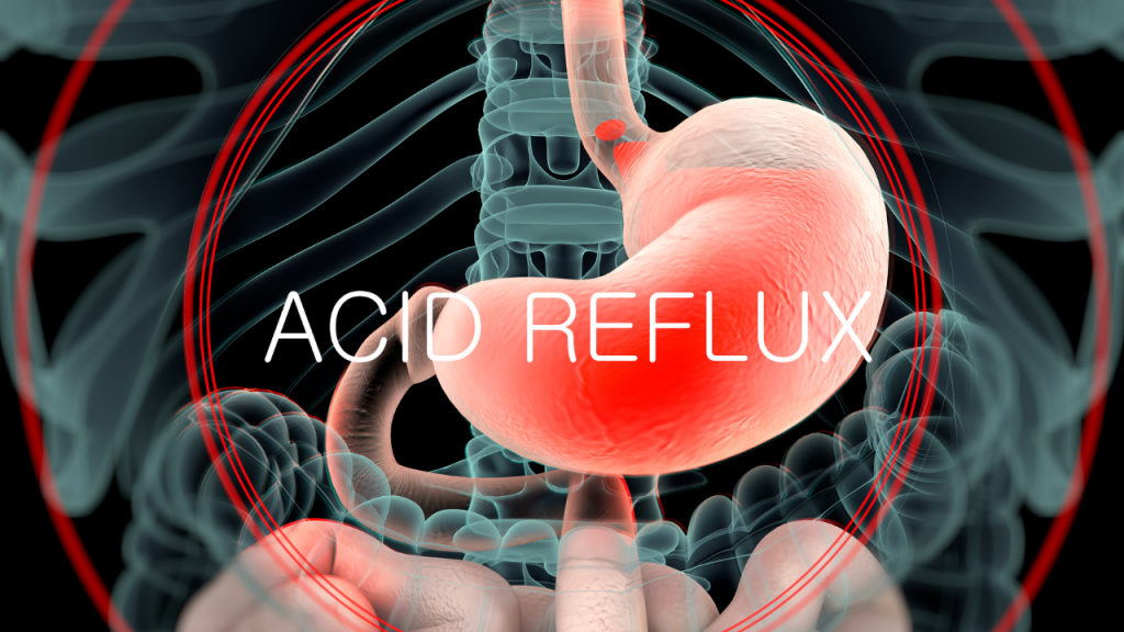 Reflux - základem je strava, program Metabolic Balance